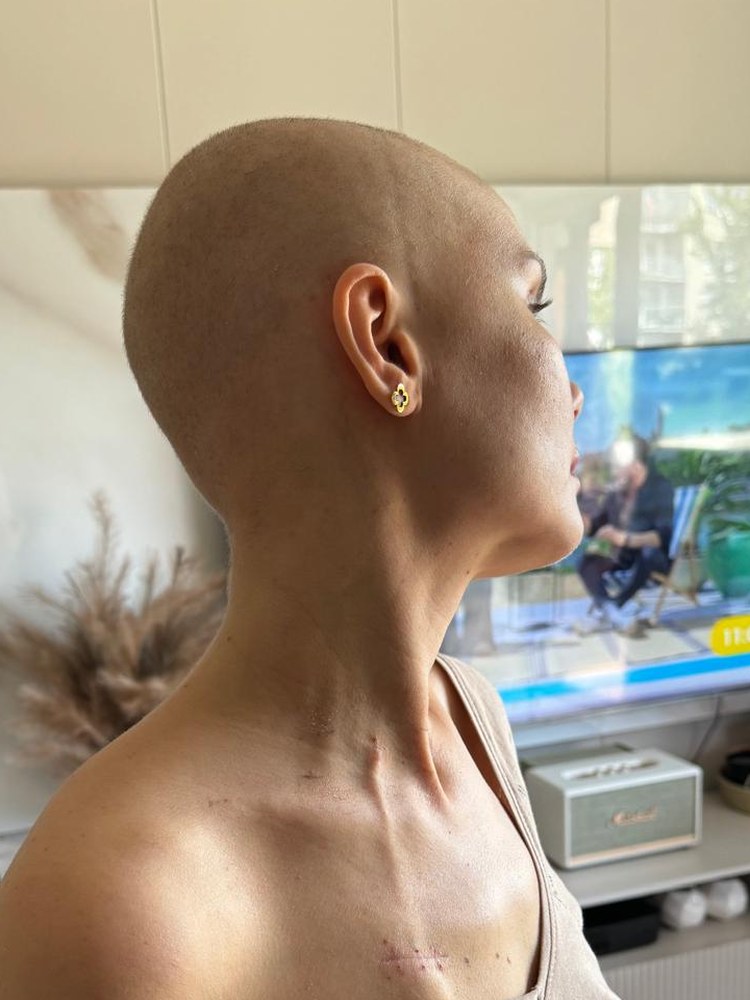 Kasia Roj w trakcie leczenia, 2024